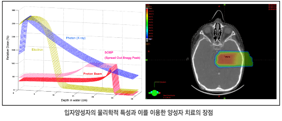 입자양성자의 물리학적 특성과 이를 이용한 양성자 치료의 장점