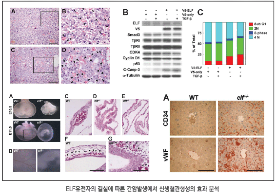 ELF유전자의 결실에 따른 간암발생에서 신생혈관형성의 효과 분석