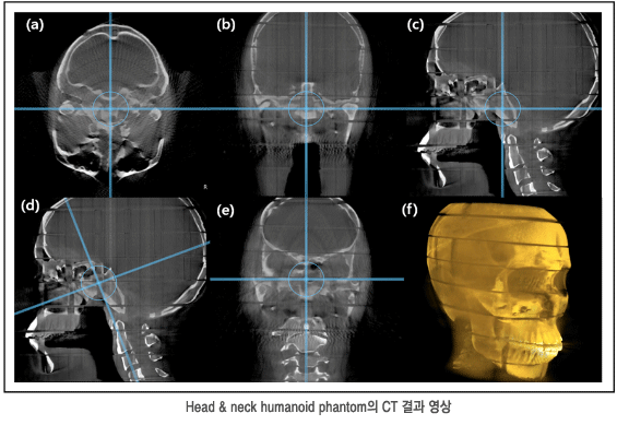 Head & neck humanoid phantom의 CT 결과 영상