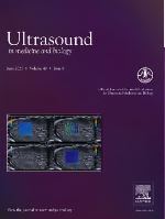 Ultrasound Speckle Decorrelation-Based Blood Flow Measurements