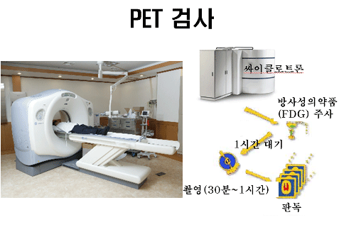 PET검사 : 싸이클로트론 → 방사성의약품(FDG) 주사 → 1시간 대기 → 촬영(30분~1시간) → 판독