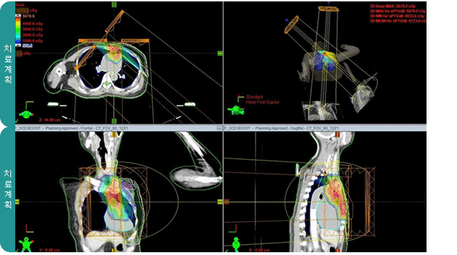 치료계획 사진
